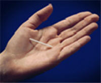 Implant contraceptif